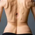 Nốt ruồi giữa lưng nữ