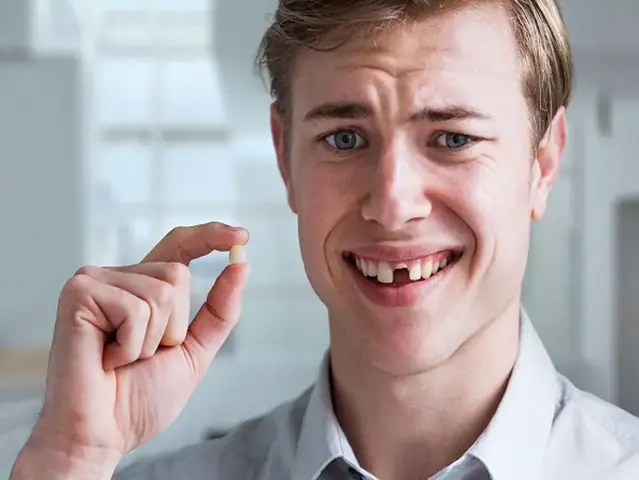 Nằm Mơ Thấy Gãy Răng: Ý Nghĩa Từ Dân Gian Đến Tâm Lý